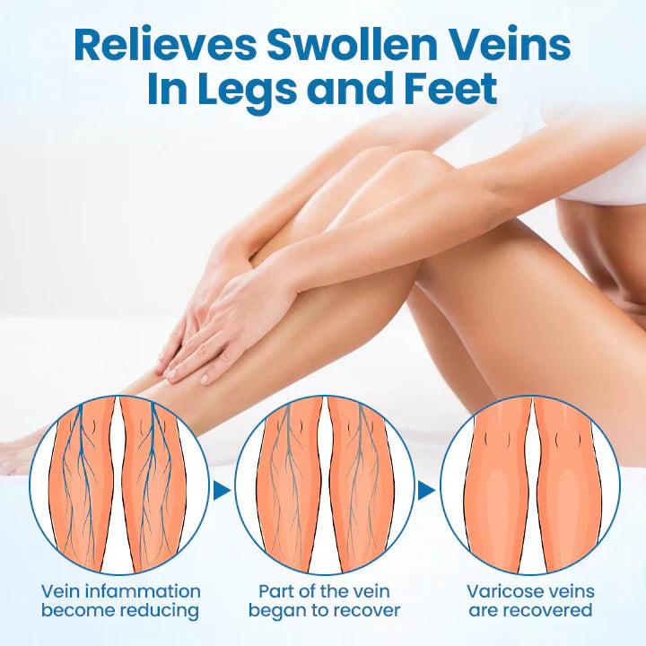 HEALRIZE® VeinGuard Herbal Spray-✅ Clinically proven to eliminate varicose veins in just 7 days!