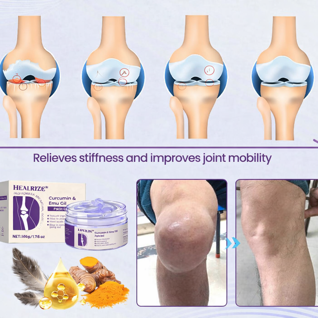 HEALRIZE®  Curcumin & Emu Oil Pain Gel – 🏥Backed by US Osteopathic Experts